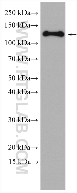 WB analysis of A431 using 28462-1-AP