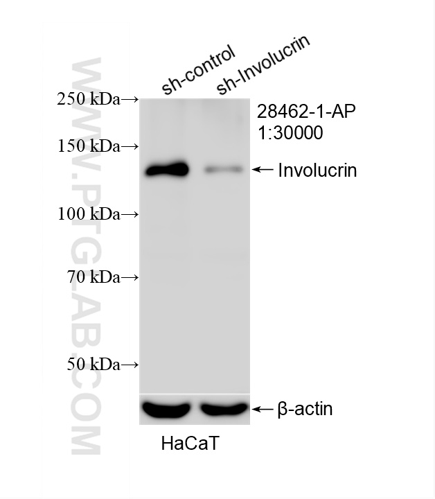 WB analysis of HaCaT using 28462-1-AP