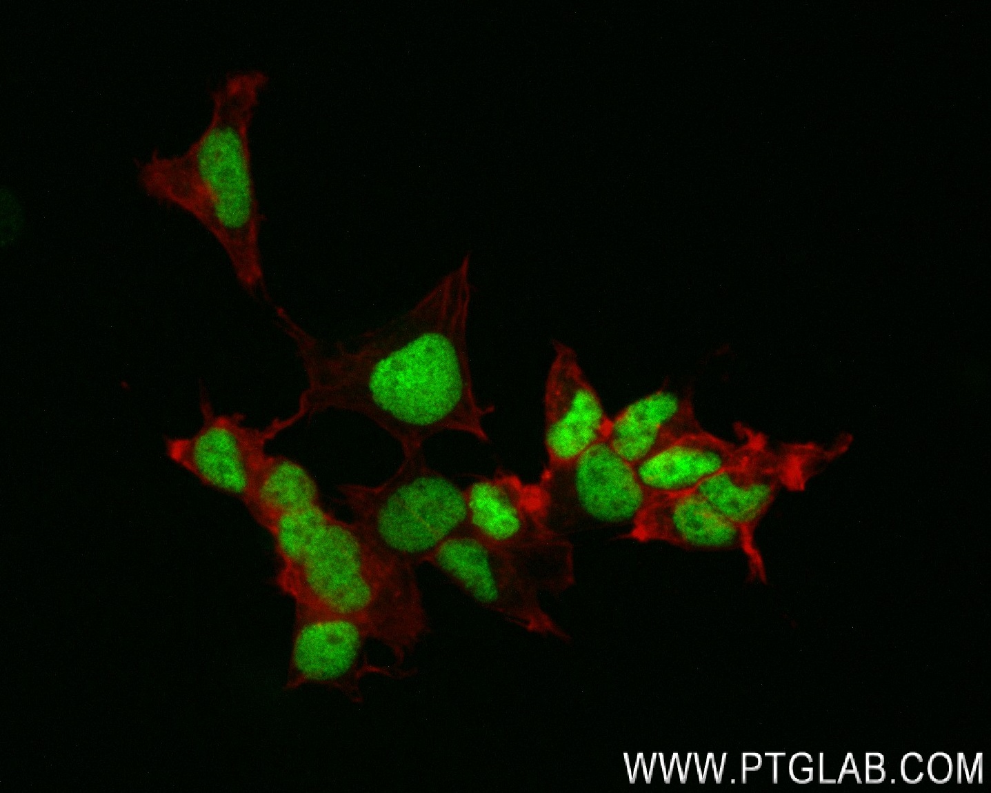 IF Staining of SH-SY5Y using 83784-4-RR