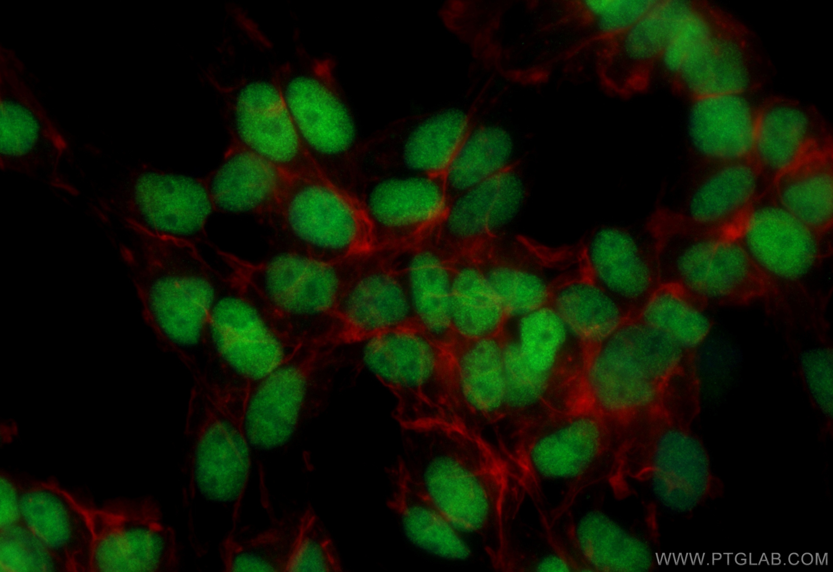 IF Staining of SH-SY5Y using CL488-83784-4