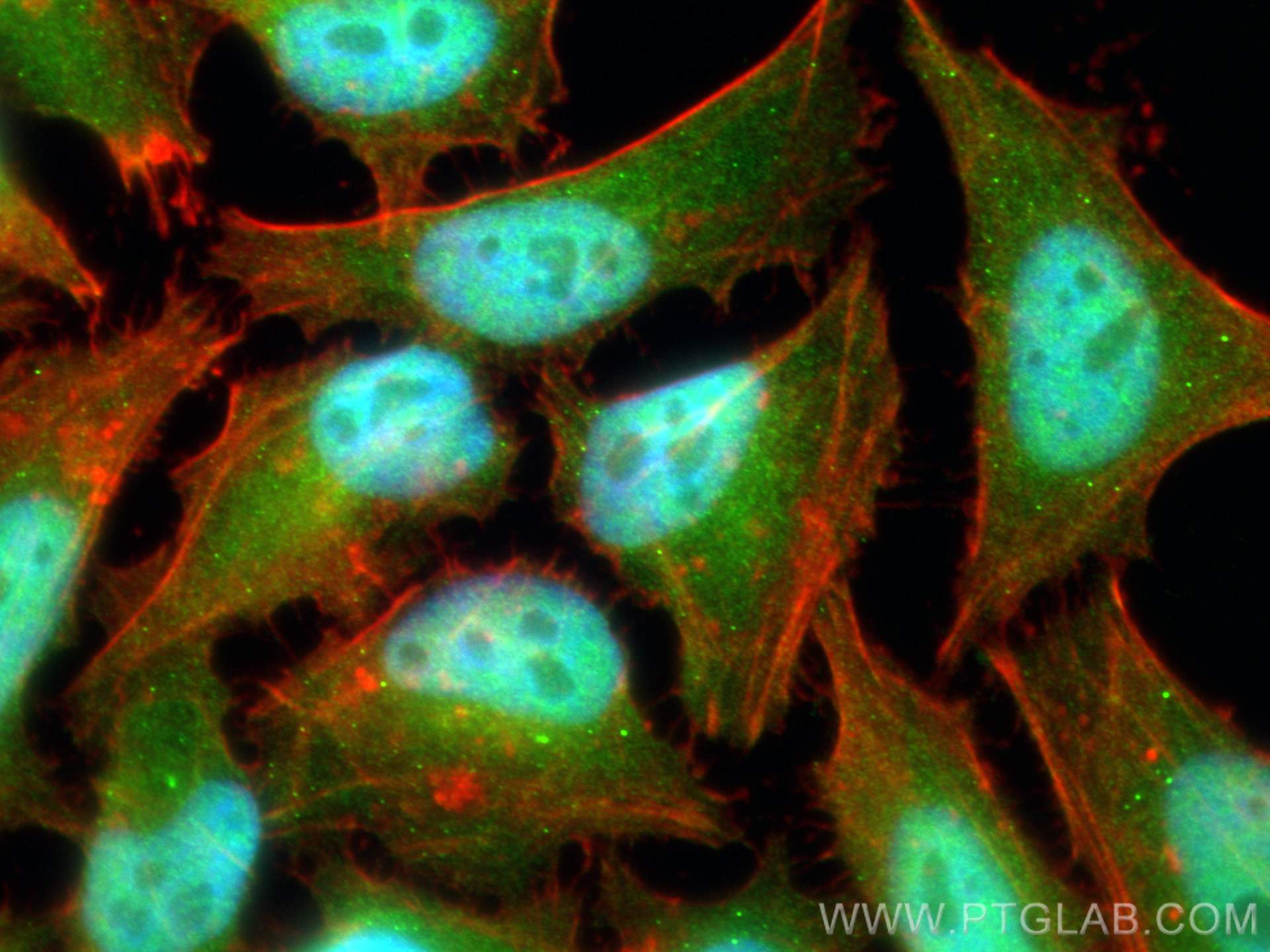 IF Staining of HeLa using 27511-1-AP