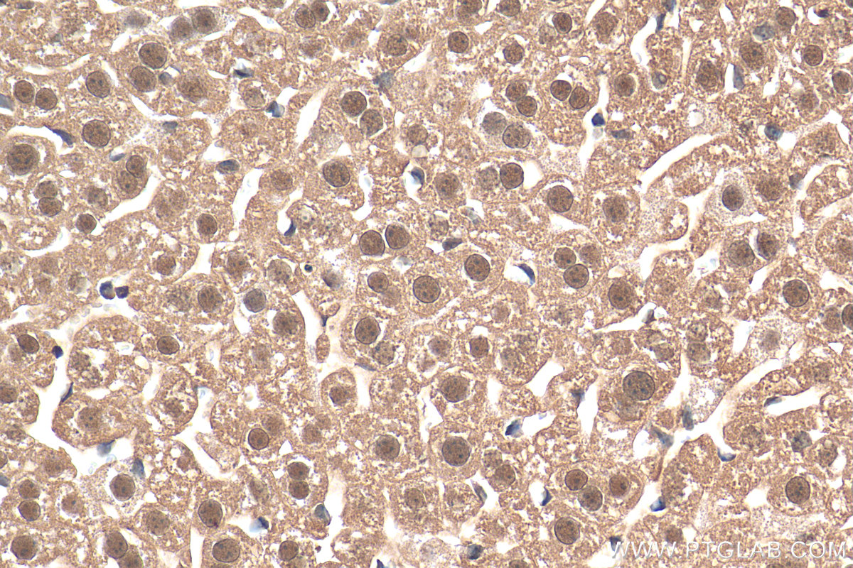 IHC staining of mouse liver using 27511-1-AP