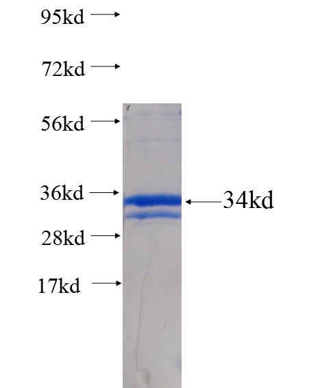 JAK1 fusion protein Ag25579 SDS-PAGE