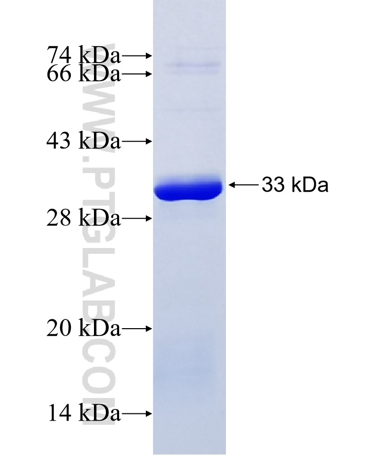 JAK3 fusion protein Ag26186 SDS-PAGE JAK3 fusion protein Ag26186 SDS-PAGE