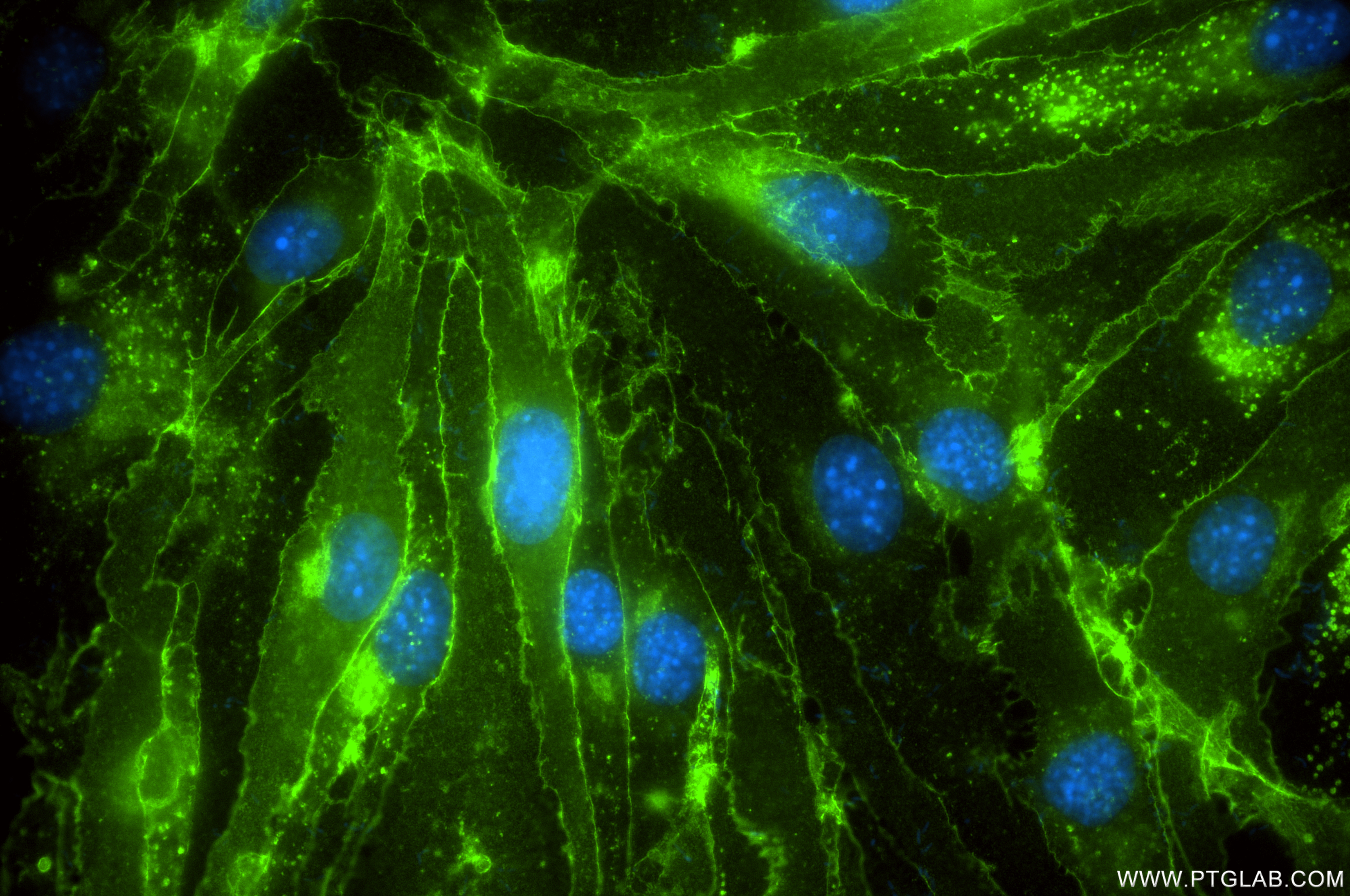 IF Staining of bEnd.3 using 86229-1-RR