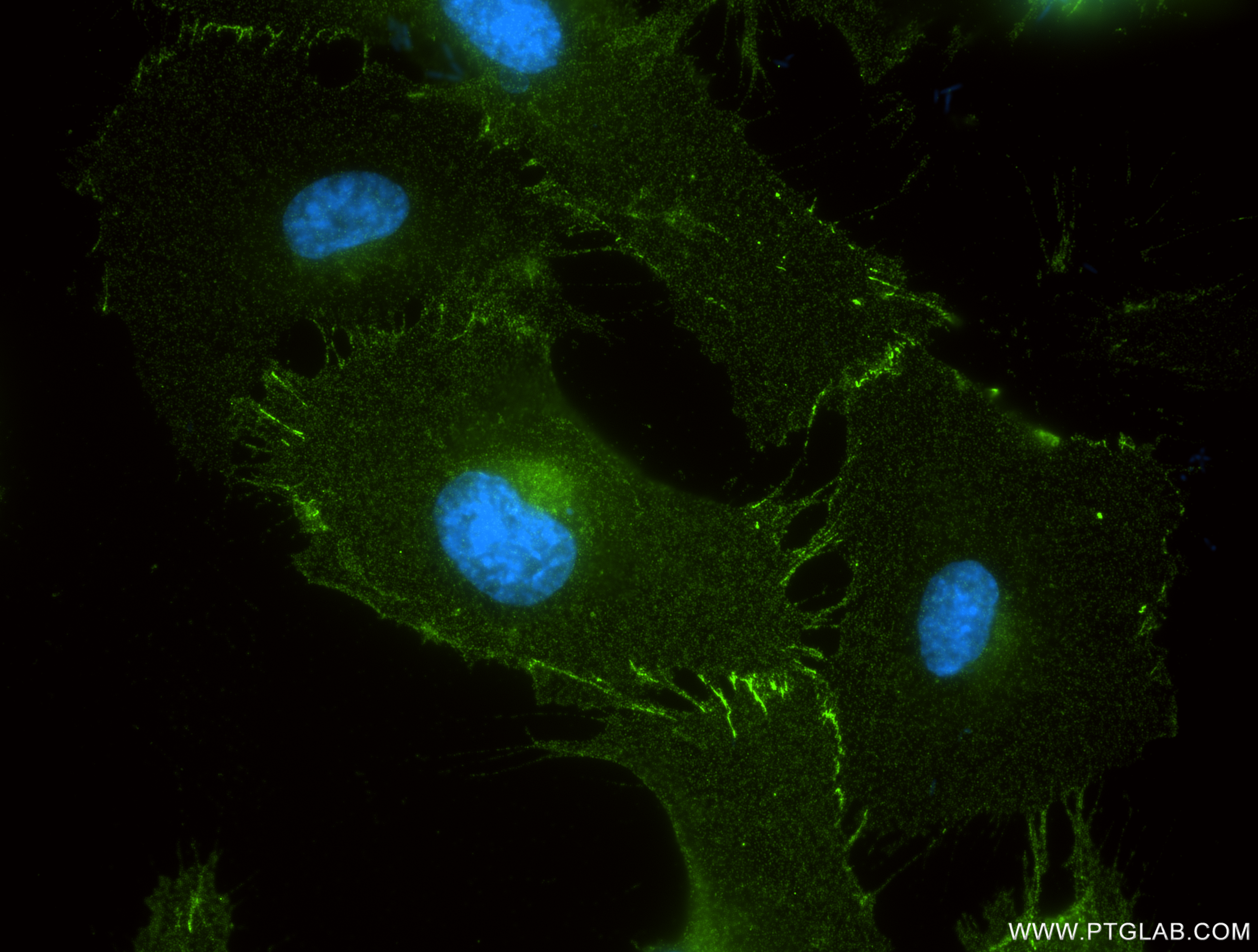 IF Staining of HUVEC using 84720-2-RR IF Staining of HUVEC using 84720-2-RR