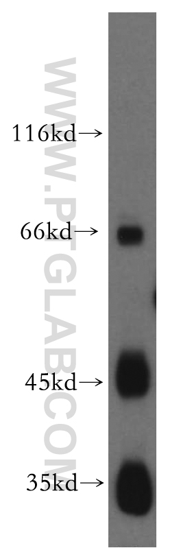 WB analysis of human placenta using 12972-1-AP