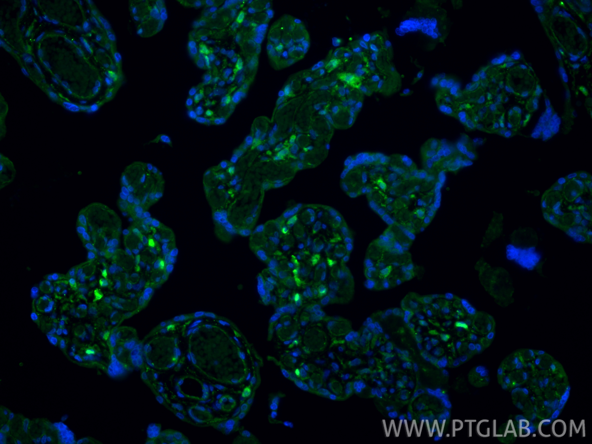 IF Staining of human placenta using 34226-1-AP