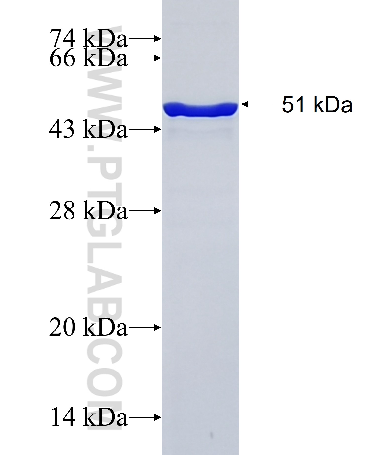JARID2 fusion protein Ag34738 SDS-PAGE