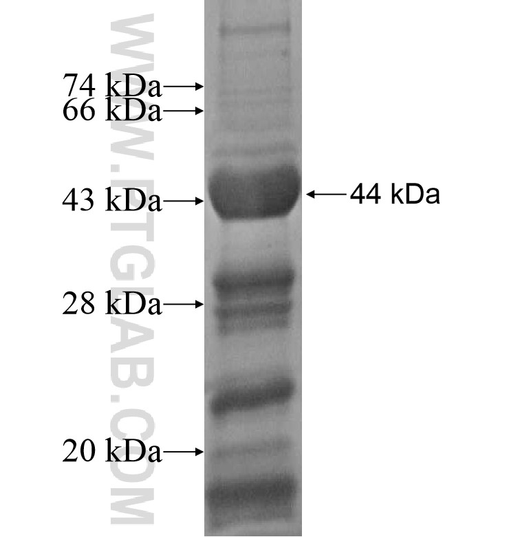 JARID2 fusion protein Ag16618 SDS-PAGE JARID2 fusion protein Ag16618 SDS-PAGE