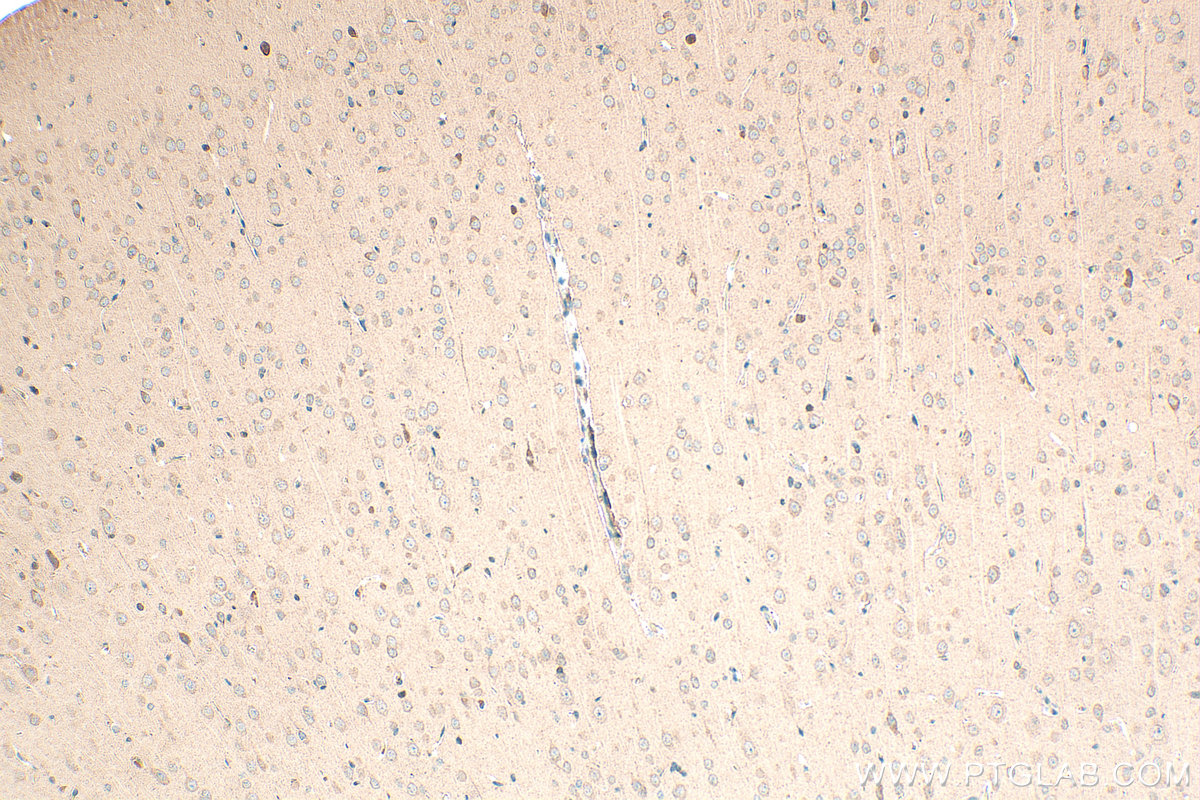 IHC staining of rat brain using 25212-1-AP