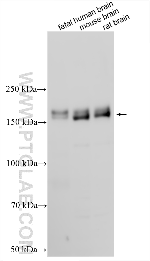 WB analysis using 25212-1-AP