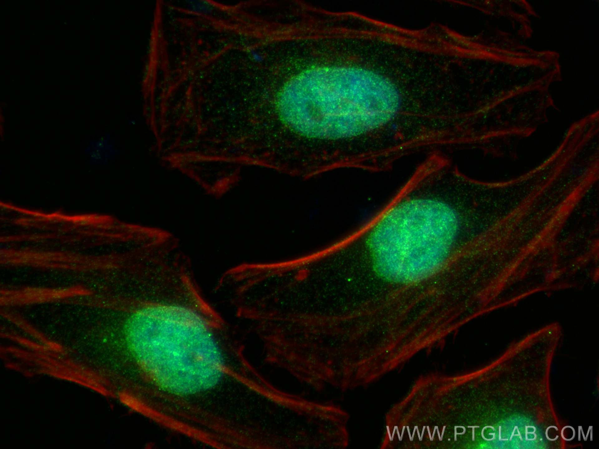 IF Staining of HeLa using 26637-1-AP