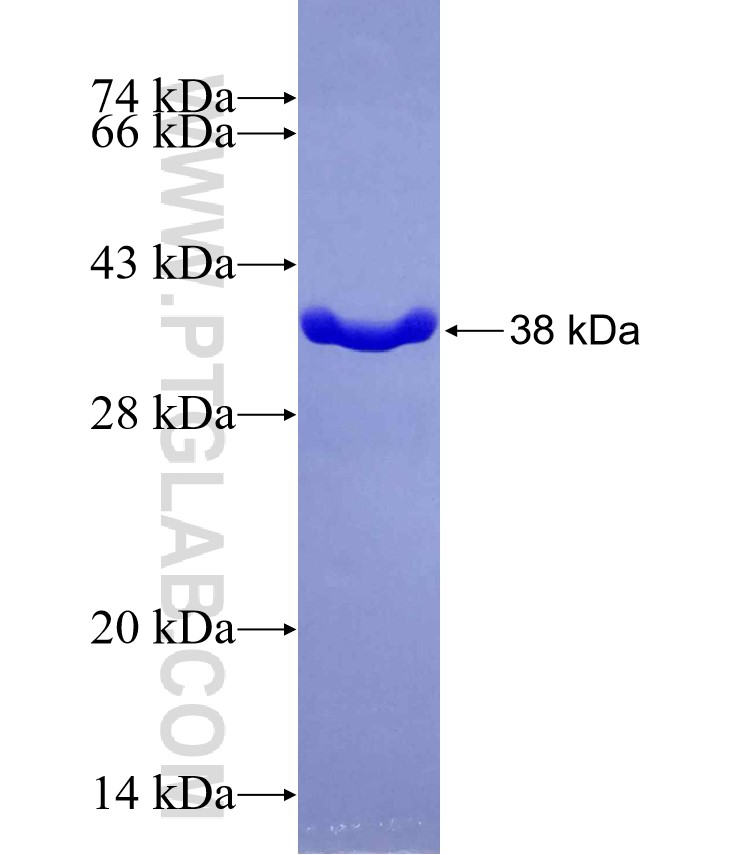 JMJD3 fusion protein Ag29559 SDS-PAGE JMJD3 fusion protein Ag29559 SDS-PAGE