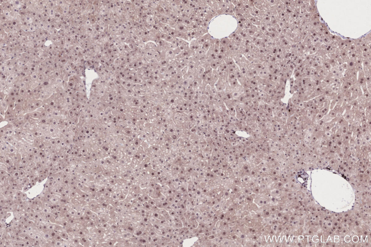 IHC staining of mouse liver using 84804-4-RR