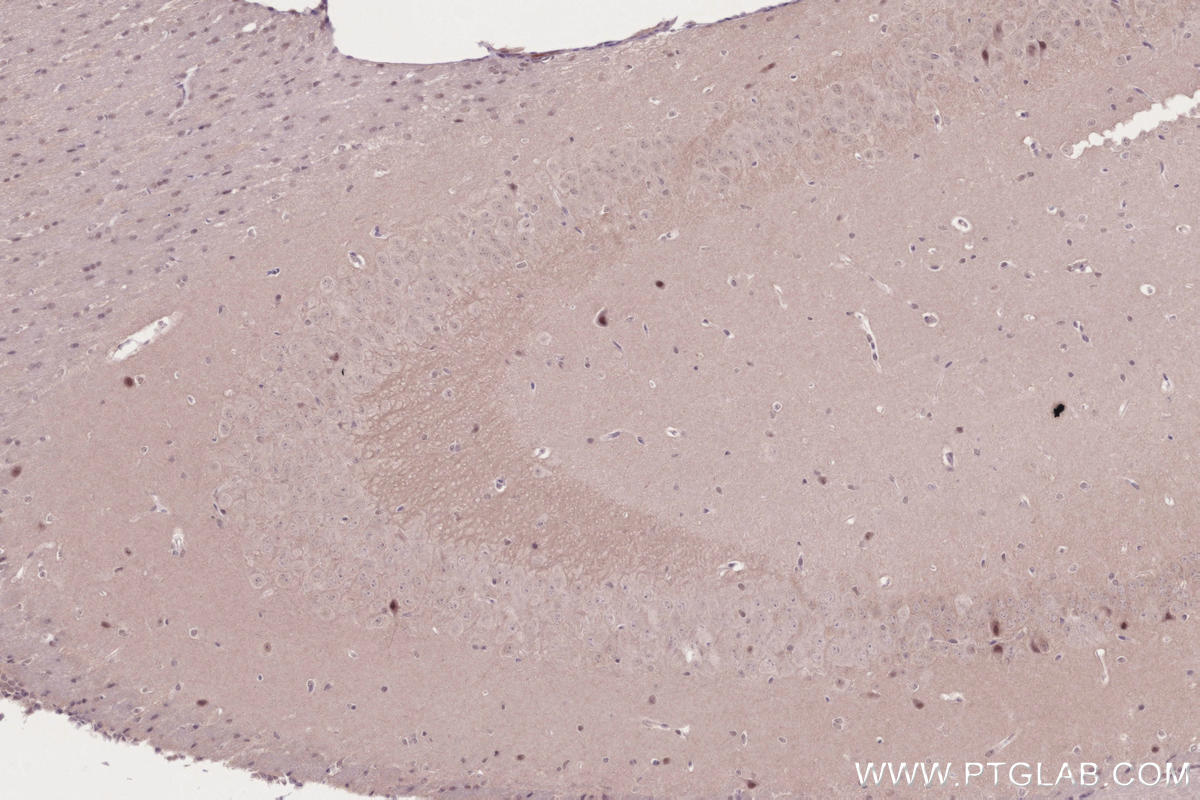 IHC staining of mouse brain using 84804-4-RR