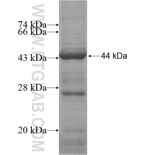 JMJD5 fusion protein Ag15256 SDS-PAGE JMJD5 fusion protein Ag15256 SDS-PAGE