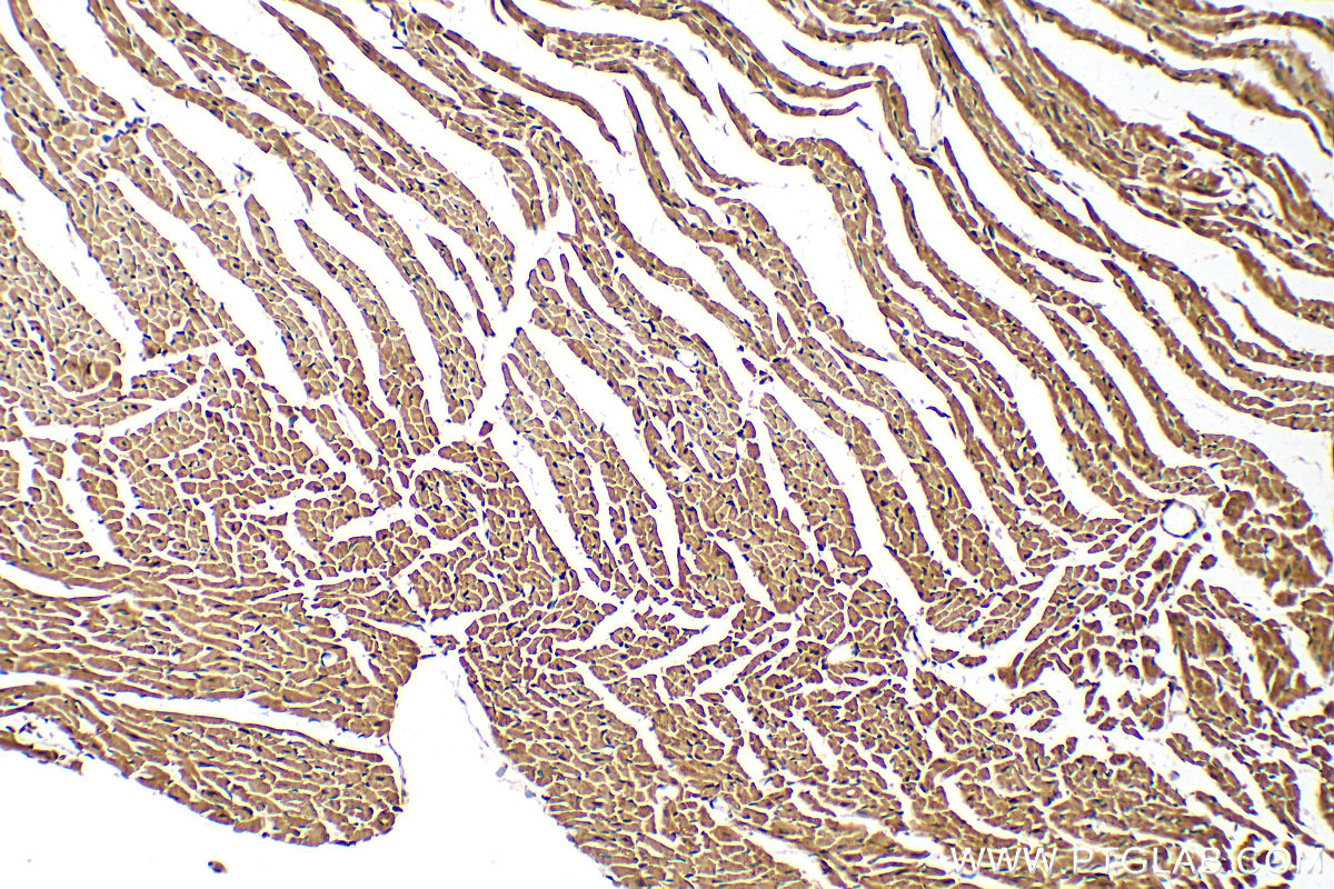 IHC staining of mouse heart using 16476-1-AP