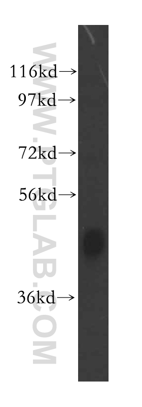 WB analysis of mouse liver using 16476-1-AP