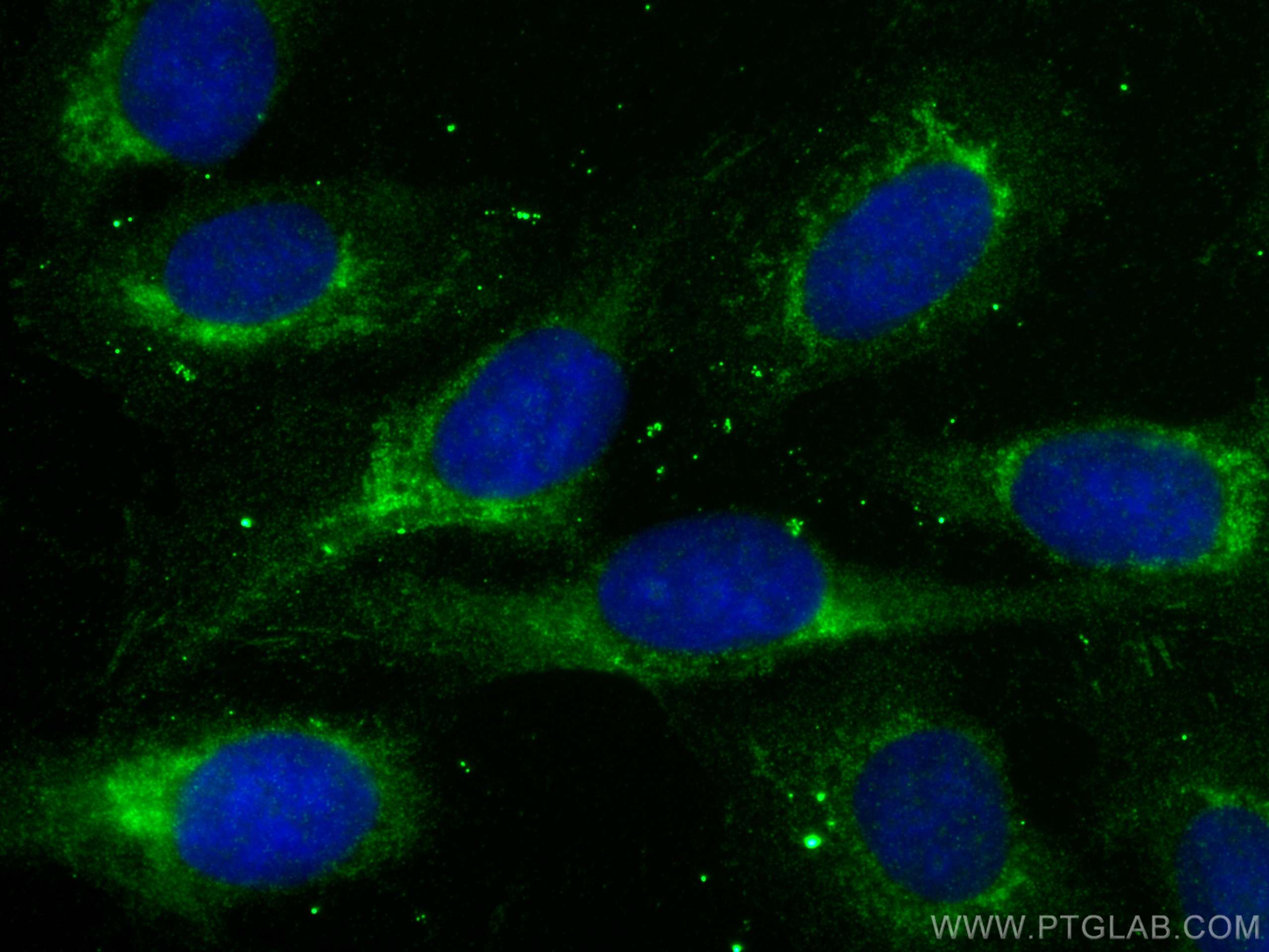 IF Staining of U2OS using 21168-1-AP IF Staining of U2OS using 21168-1-AP