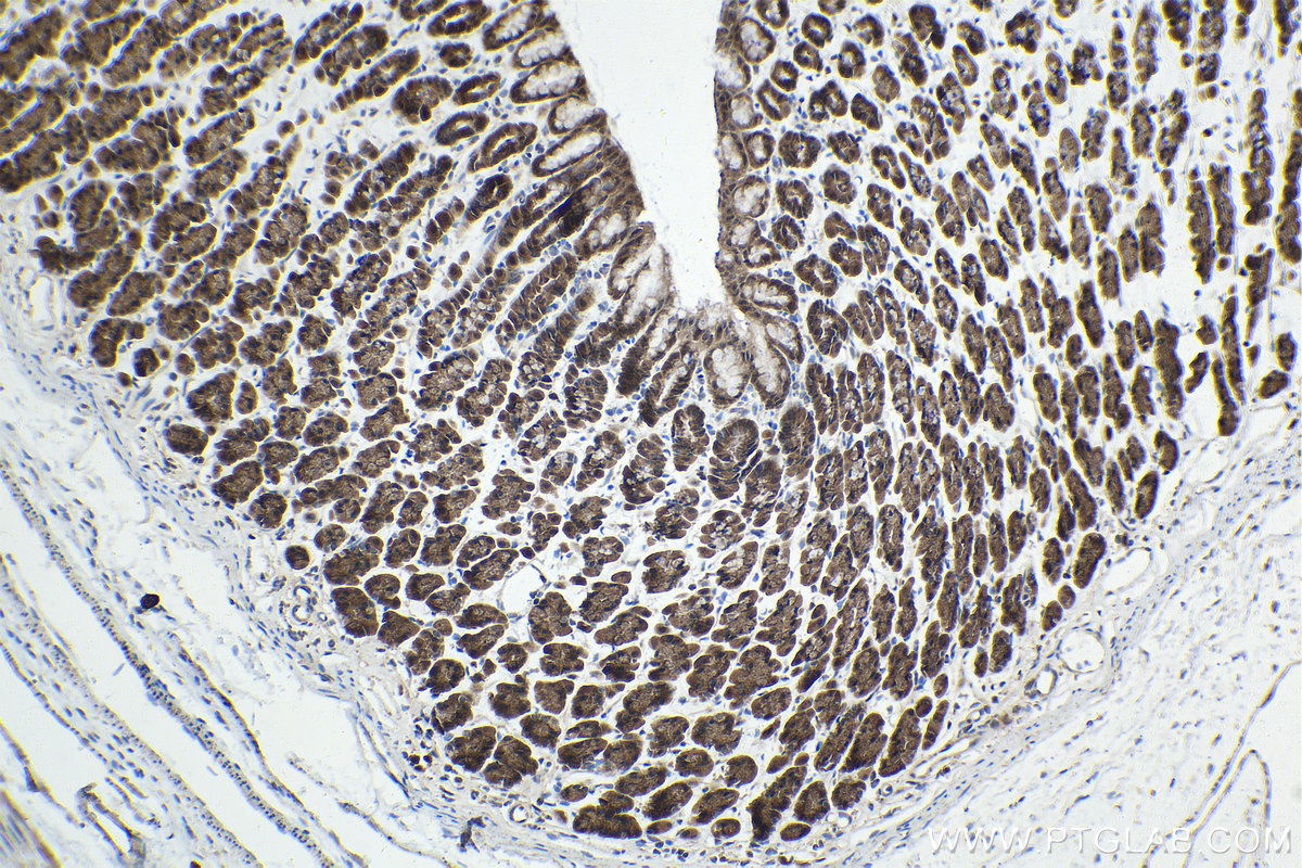 IHC staining of rat stomach using 21168-1-AP IHC staining of rat stomach using 21168-1-AP