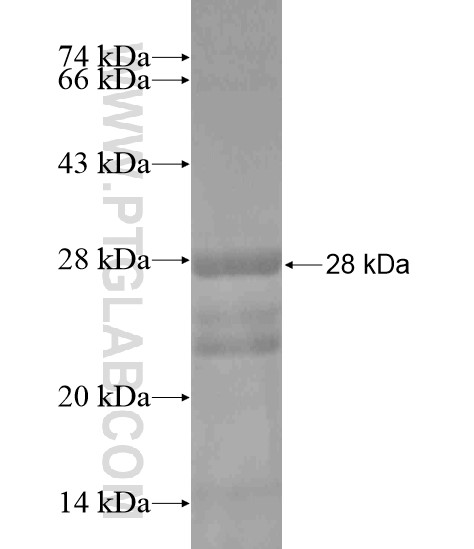 JMJD8 fusion protein Ag19682 SDS-PAGE JMJD8 fusion protein Ag19682 SDS-PAGE