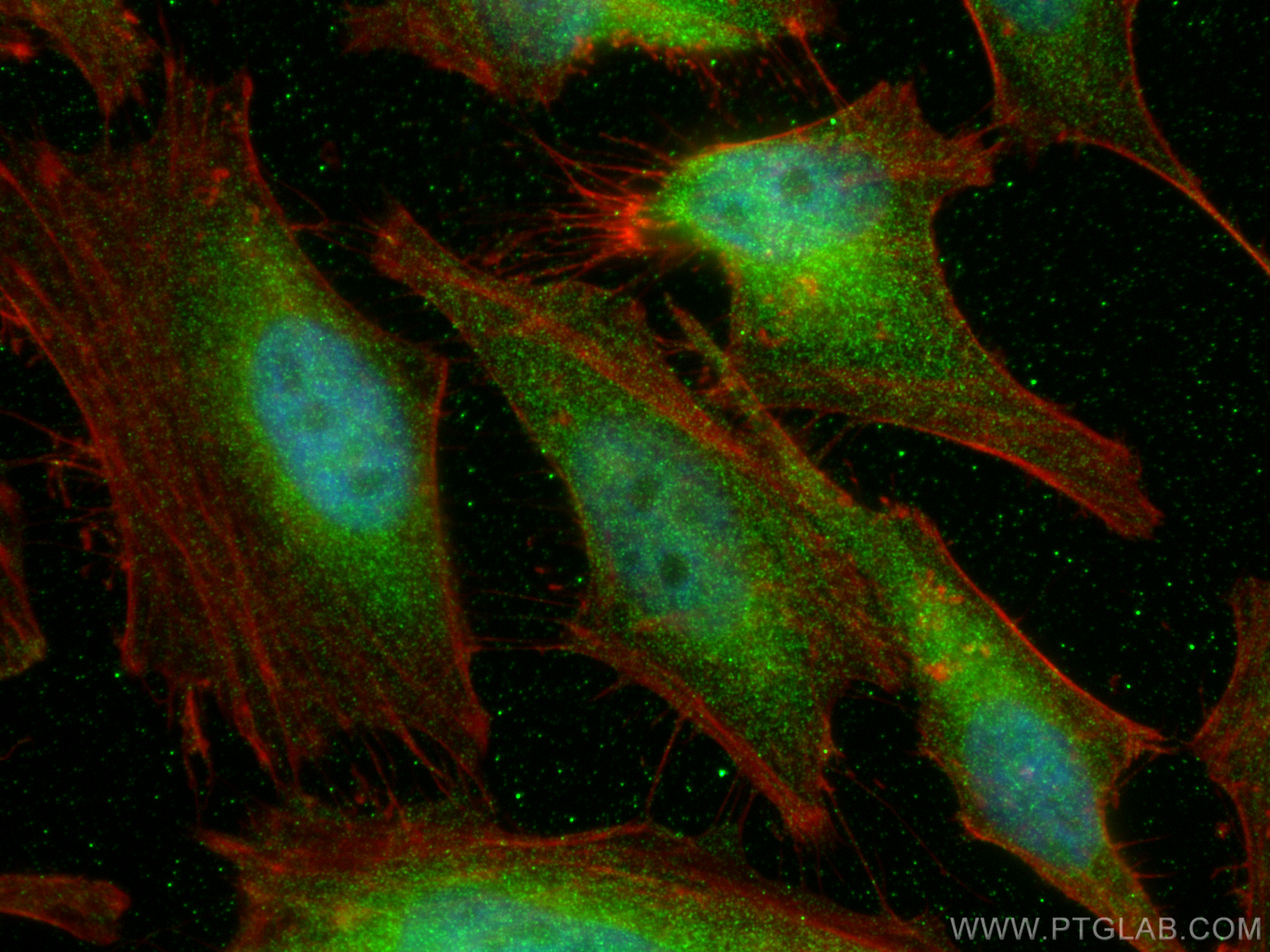 IF Staining of HeLa using 81629-1-RR (same clone as 81629-1-PBS)