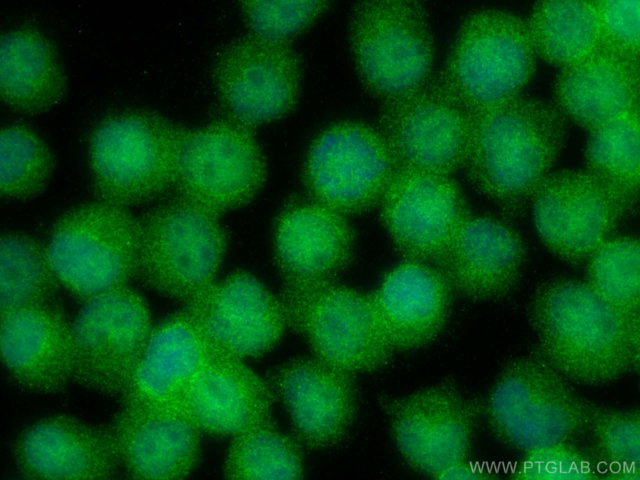 IF Staining of Jurkat using 81629-1-RR (same clone as 81629-1-PBS)