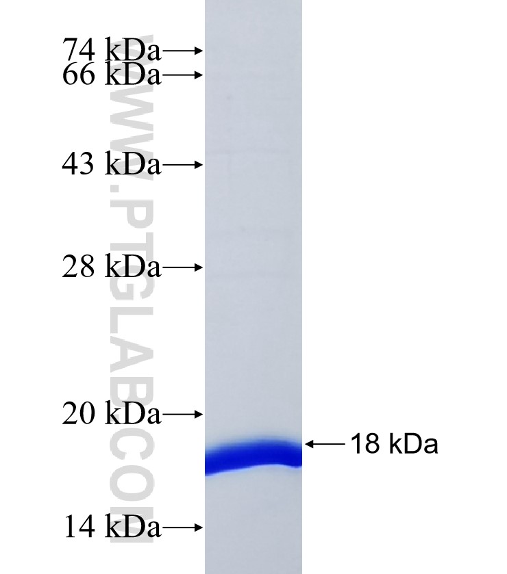 JOSD2 fusion protein Ag37159 SDS-PAGE JOSD2 fusion protein Ag37159 SDS-PAGE