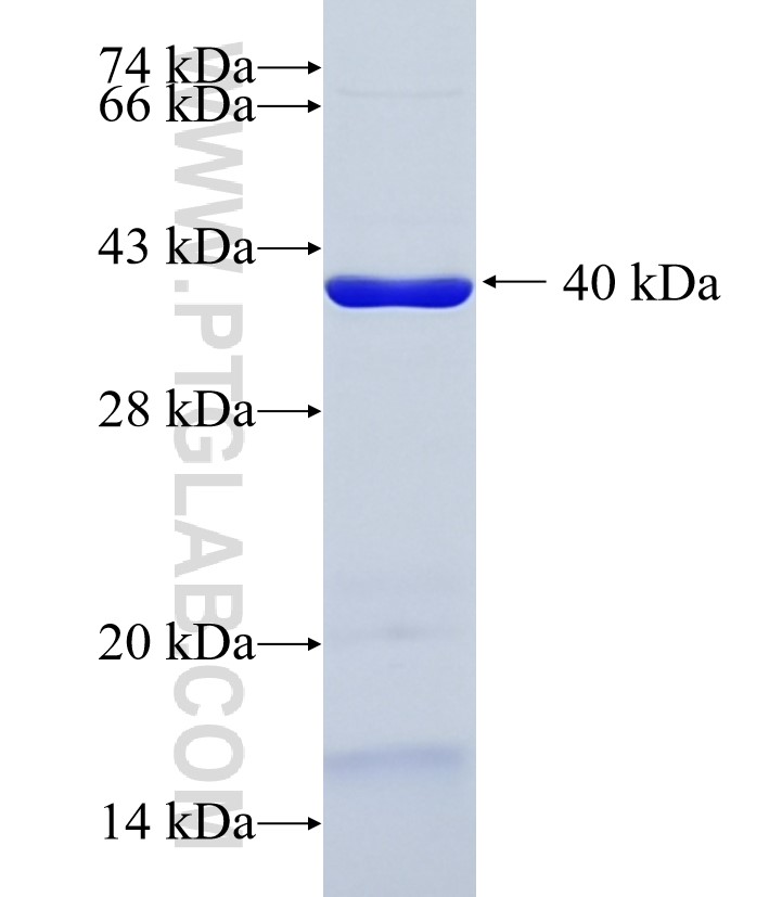 JPH2 fusion protein Ag36335 SDS-PAGE JPH2 fusion protein Ag36335 SDS-PAGE
