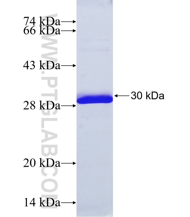 JPH4 fusion protein Ag38398 SDS-PAGE
