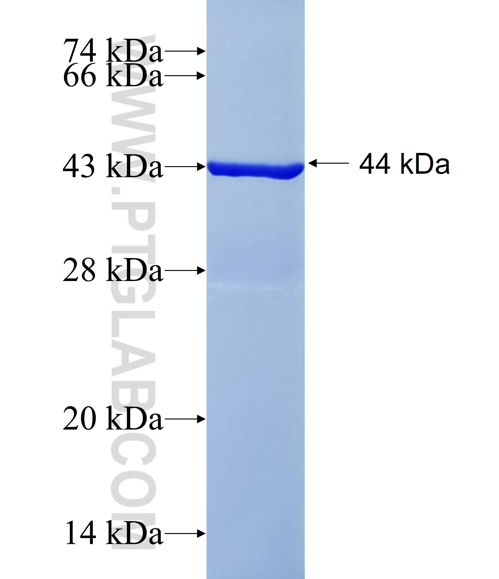 JRK fusion protein Ag38540 SDS-PAGE