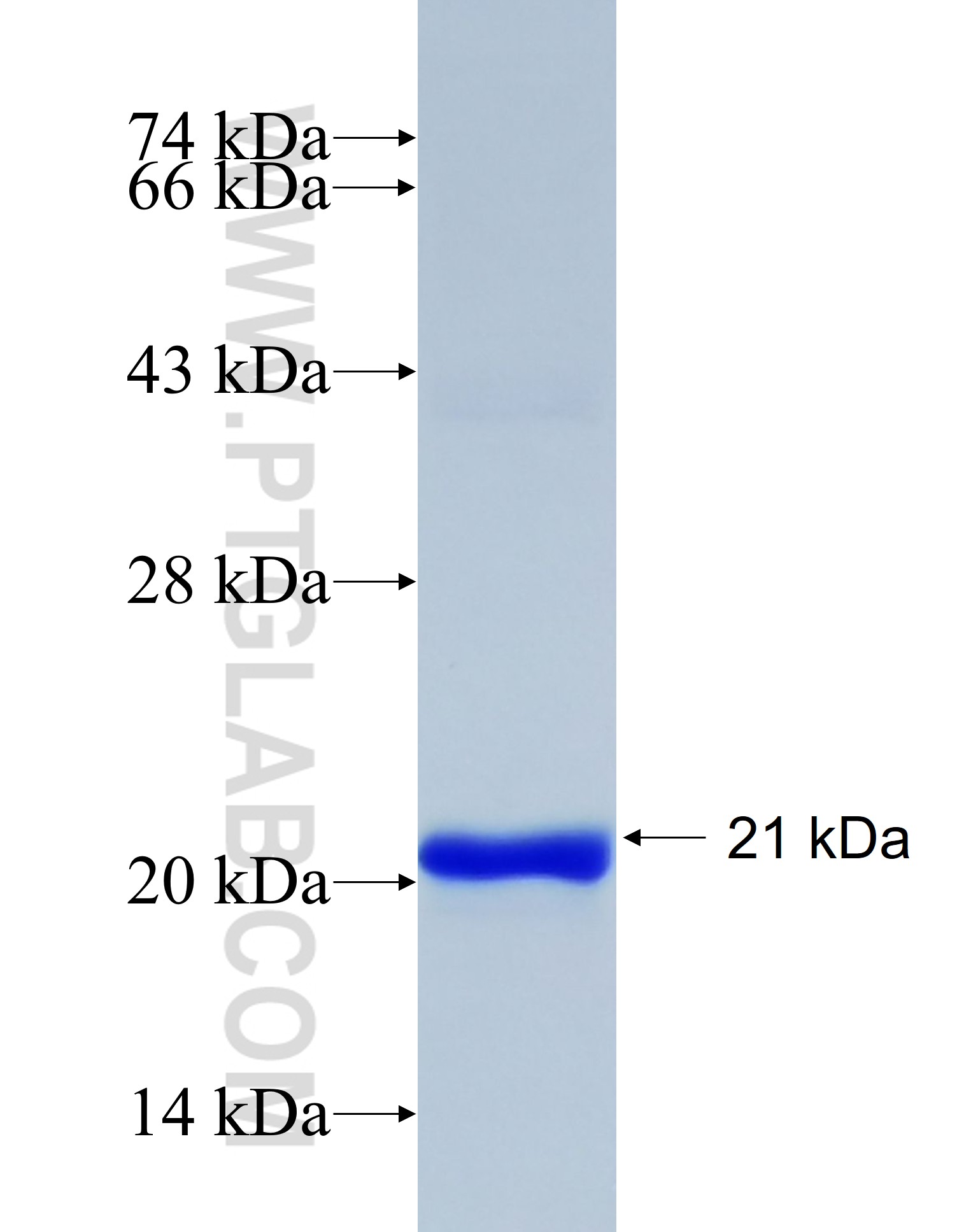 JRK fusion protein Ag38558 SDS-PAGE JRK fusion protein Ag38558 SDS-PAGE