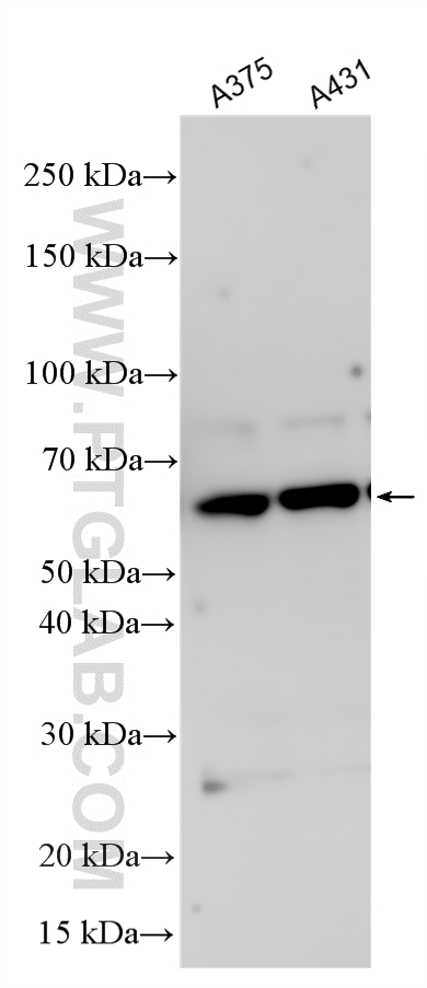 Various lysates were subjected to SDS PAGE followed by western blot with 33618-1-AP (JRKL antibody) at dilution of 1:1000 incubated at room temperature for 1.5 hours. WB analysis using 33618-1-AP