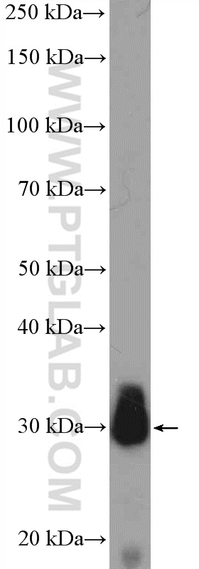 WB analysis of human skeletal muscle using 10854-1-AP