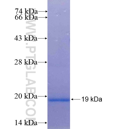 JTB fusion protein Ag13164 SDS-PAGE JTB fusion protein Ag13164 SDS-PAGE