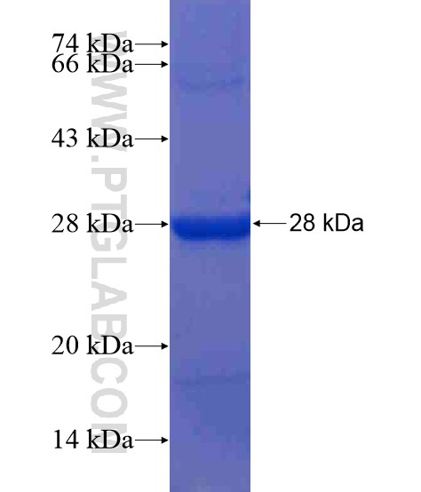JTV1 fusion protein Ag21281 SDS-PAGE