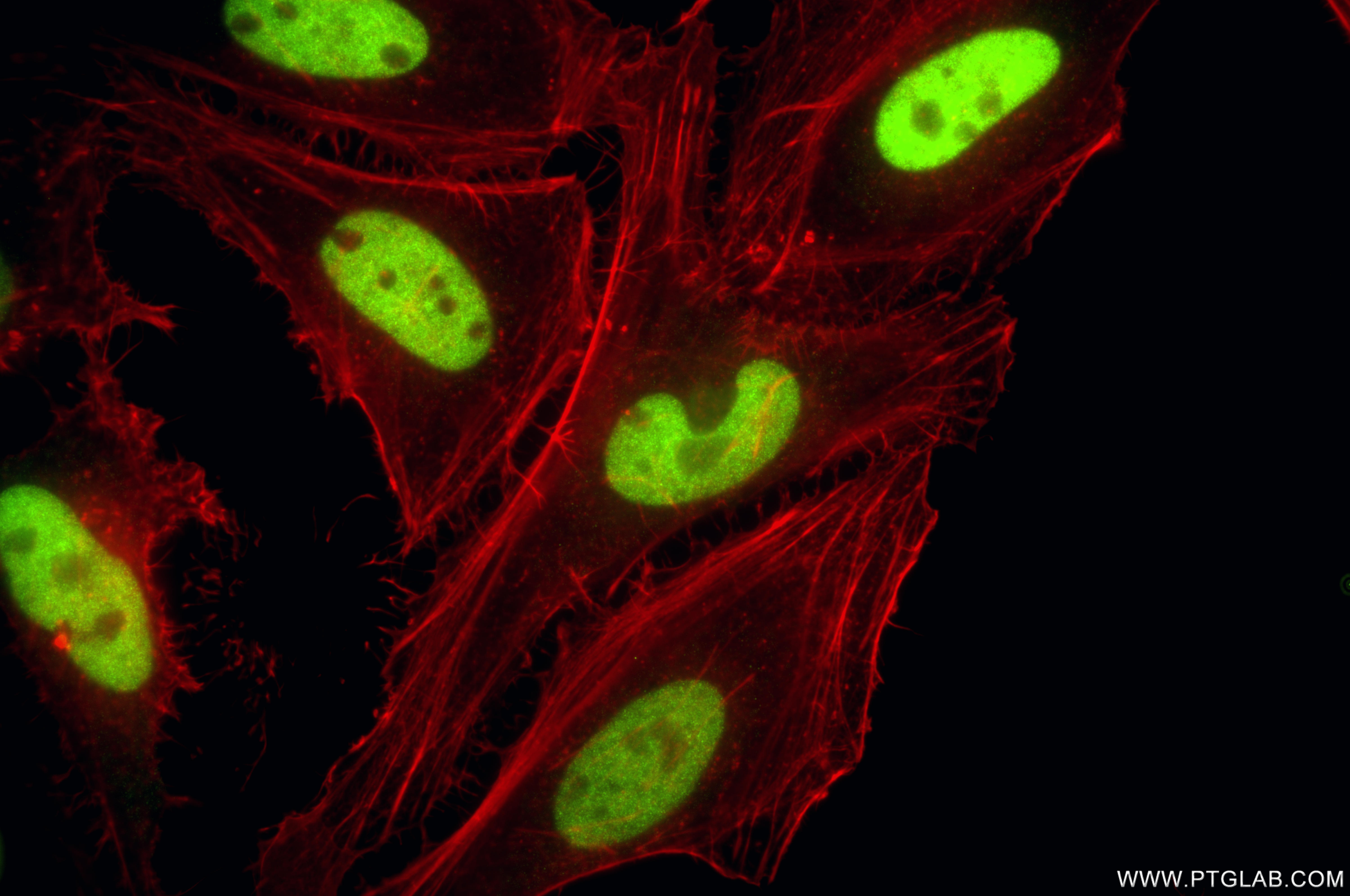 IF Staining of HeLa using 81667-5-RR (same clone as 81667-5-PBS) IF Staining of HeLa using 81667-5-RR (same clone as 81667-5-PBS)