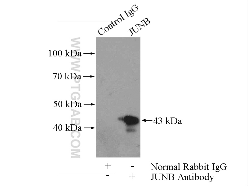 IP experiment of HeLa using 10486-1-AP