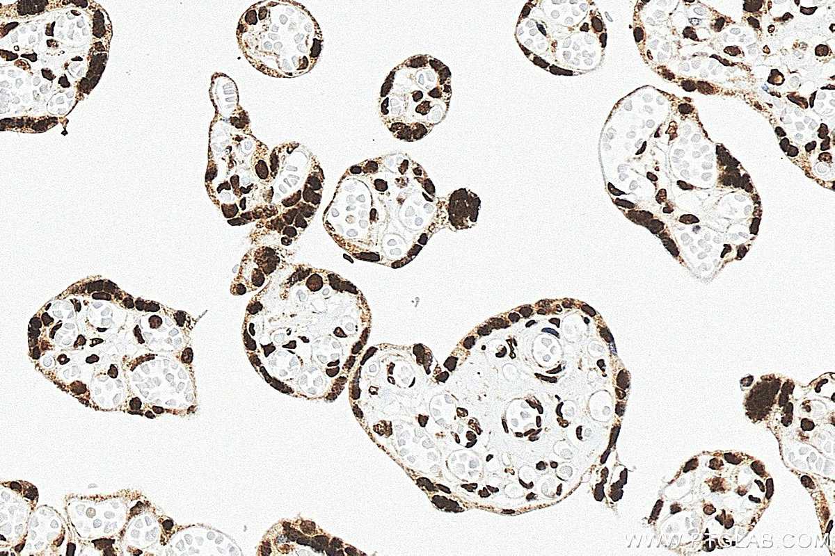 IHC staining of human placenta using 83134-6-RR IHC staining of human placenta using 83134-6-RR