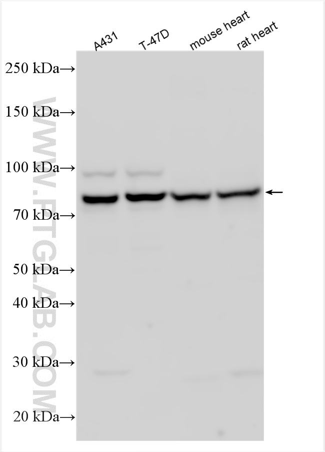 WB analysis using 11146-1-AP
