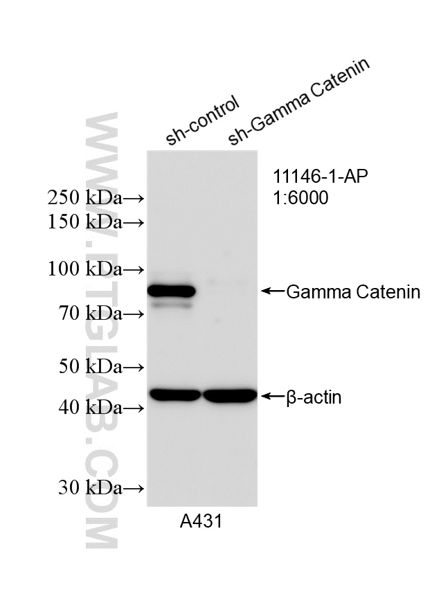 WB analysis of A431 using 11146-1-AP WB analysis of A431 using 11146-1-AP