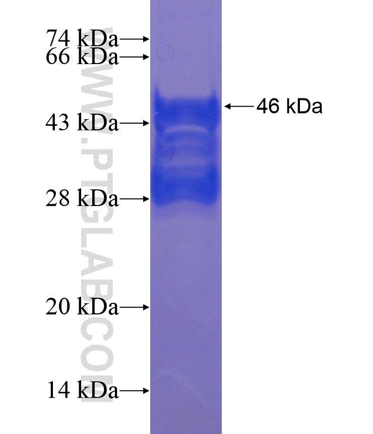 JUP fusion protein Ag17560 SDS-PAGE JUP fusion protein Ag17560 SDS-PAGE
