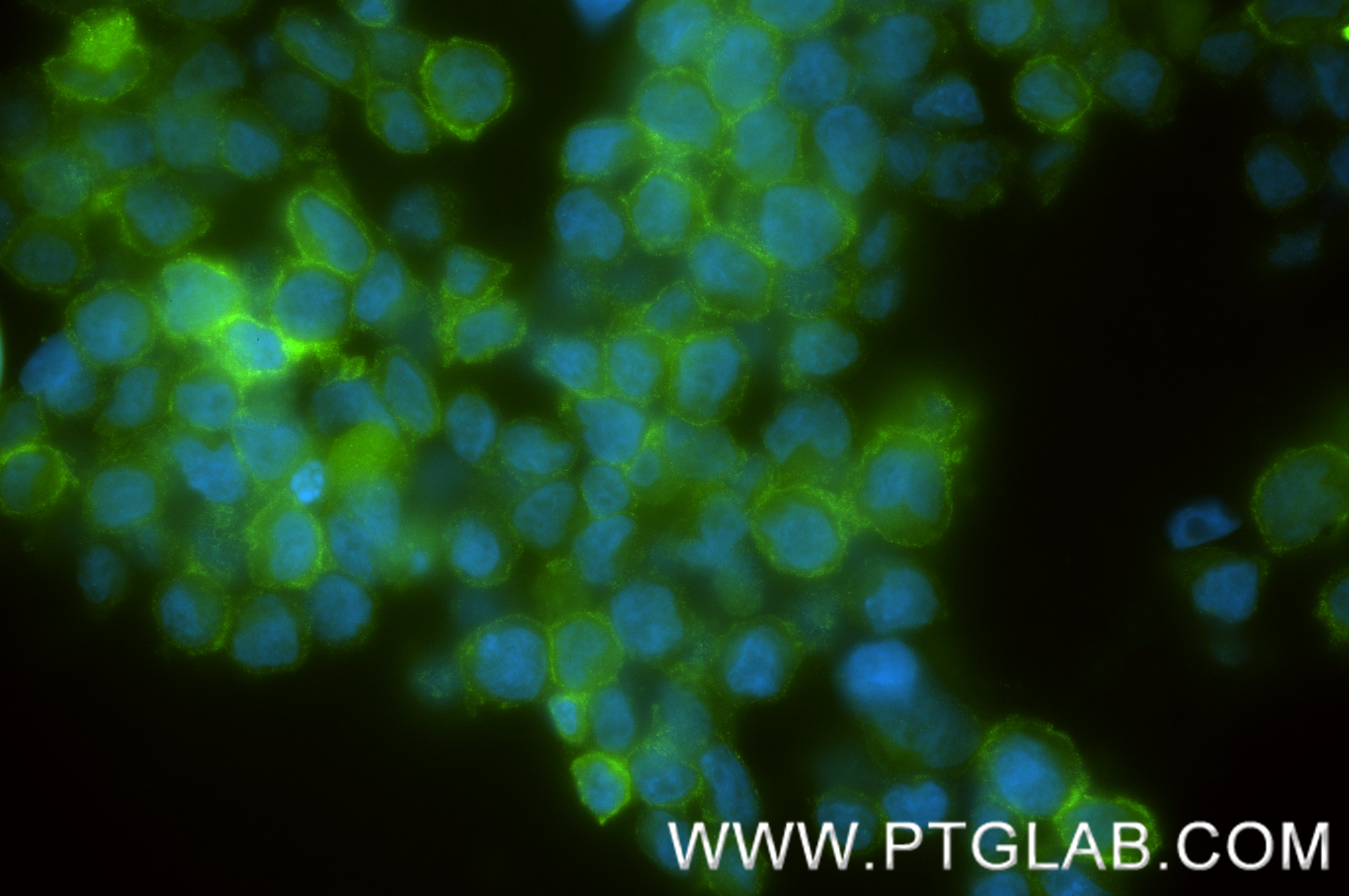 Immunofluorescent analysis of (4% PFA) fixed IM-9 cells using Jagged1/CD339 antibody (<a class='green' href='/productredirect?CatalogNo=84694-1-RR' target='_blank'>84694-1-RR</a>, Clone: 241412F1 ) at dilution of 1:400 and CoraLite®488-Conjugated Goat Anti-Rabbit IgG(H+L) (<a class='green' href='/productredirect?CatalogNo=SA00013-2' target='_blank'>SA00013-2</a>). This data was developed using the same antibody clone with 84694-1-PBS in a different storage buffer formulation. IF Staining of IM-9 using 84694-1-RR (same clone as 84694-1-PBS)