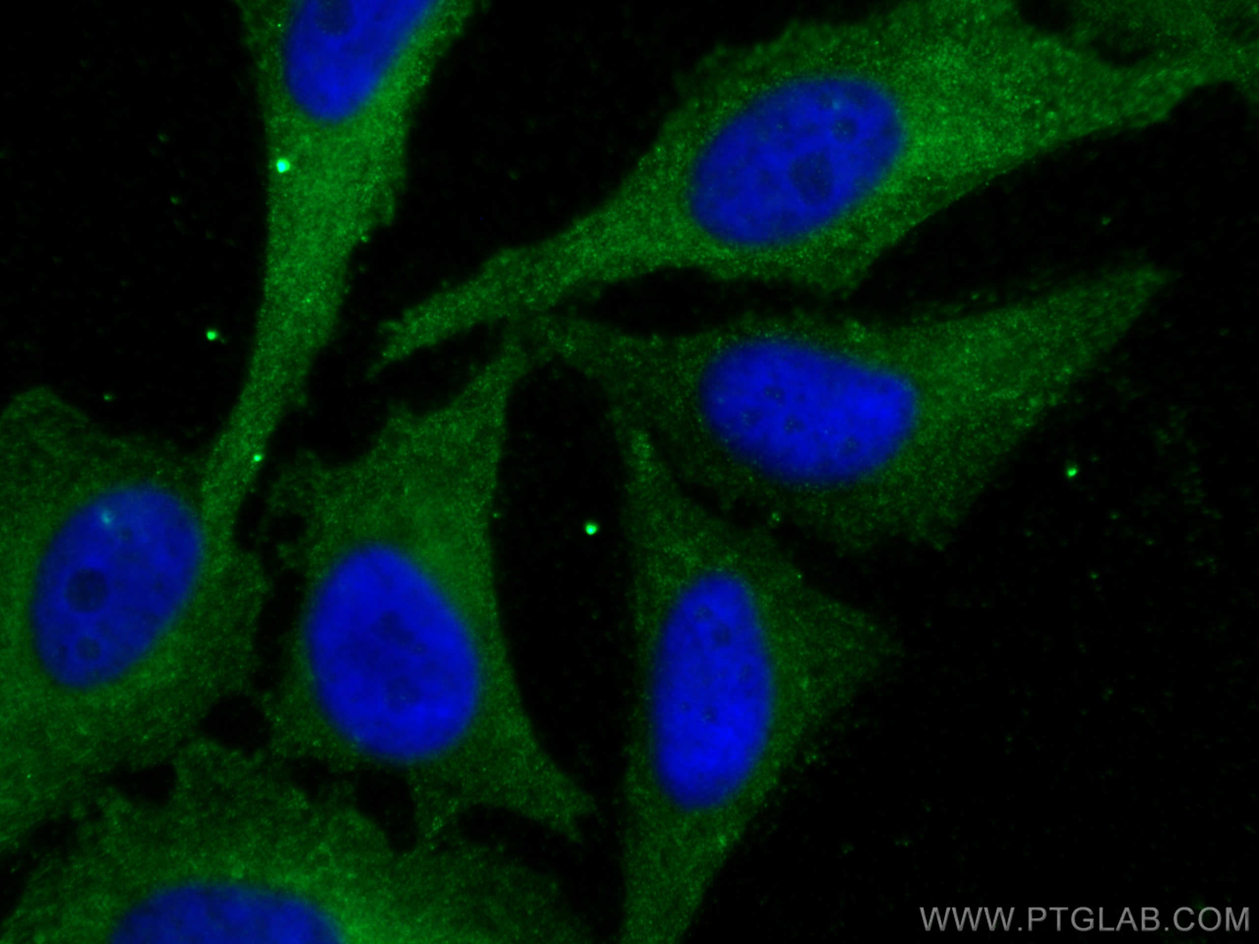 IF Staining of HeLa using 19740-1-AP