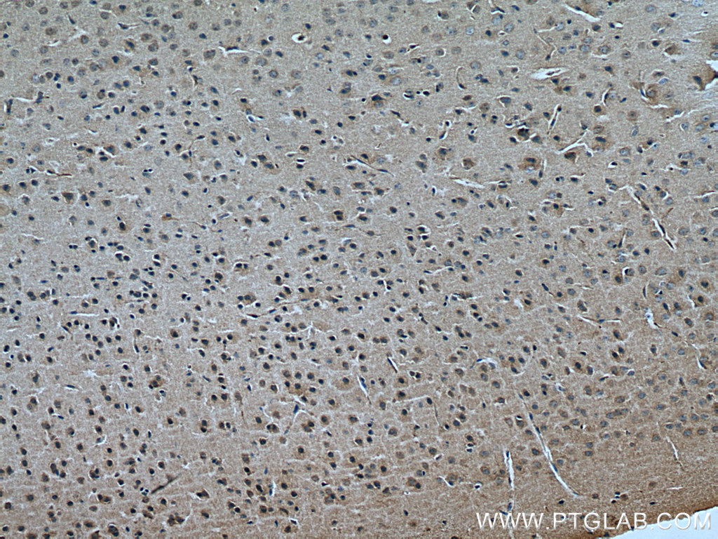 IHC staining of mouse brain using 19740-1-AP