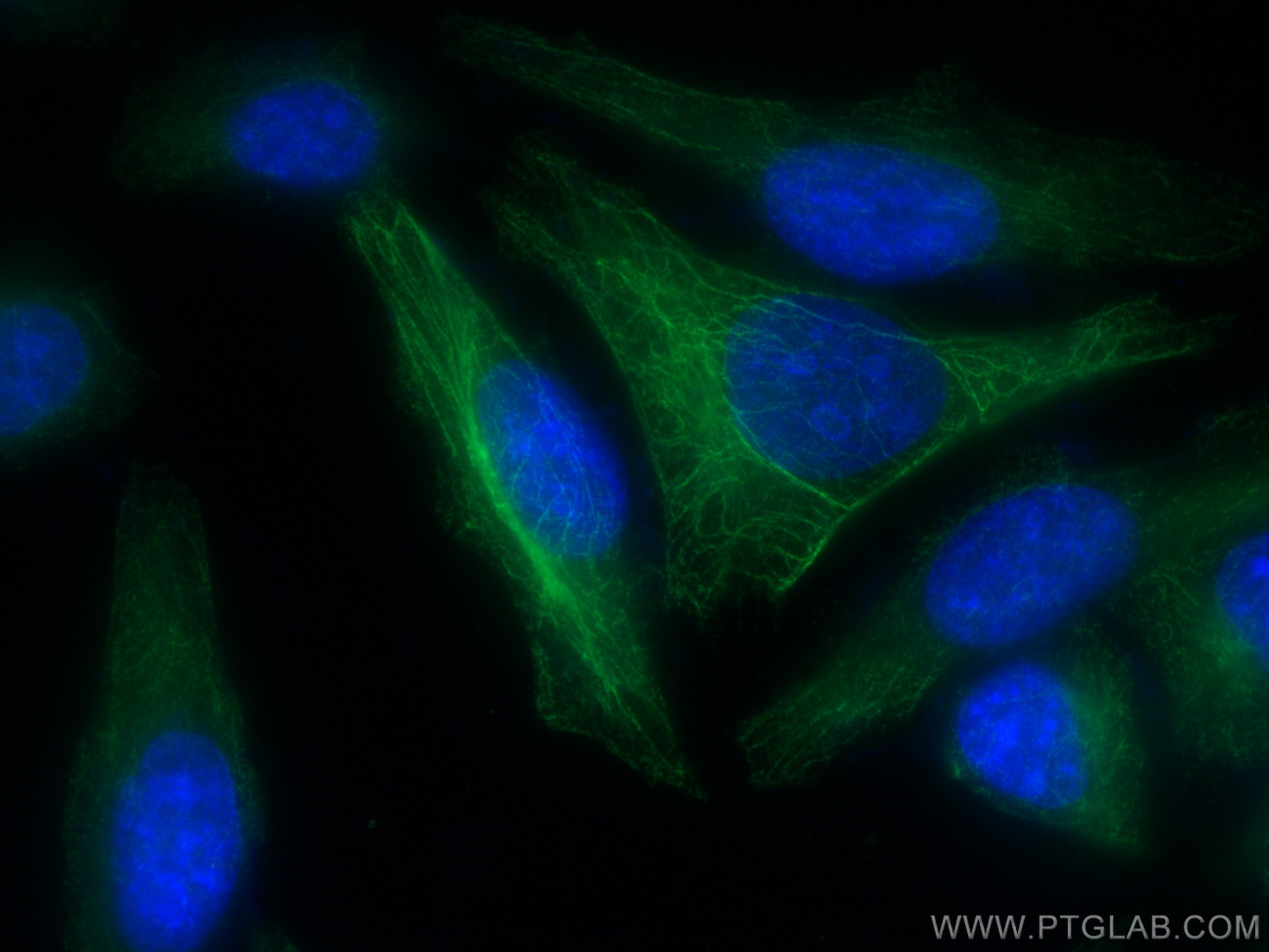 IF Staining of HepG2 using 21733-1-AP