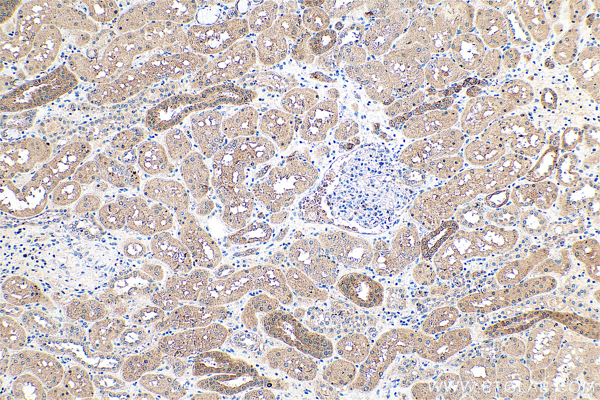 IHC staining of human kidney using 21733-1-AP