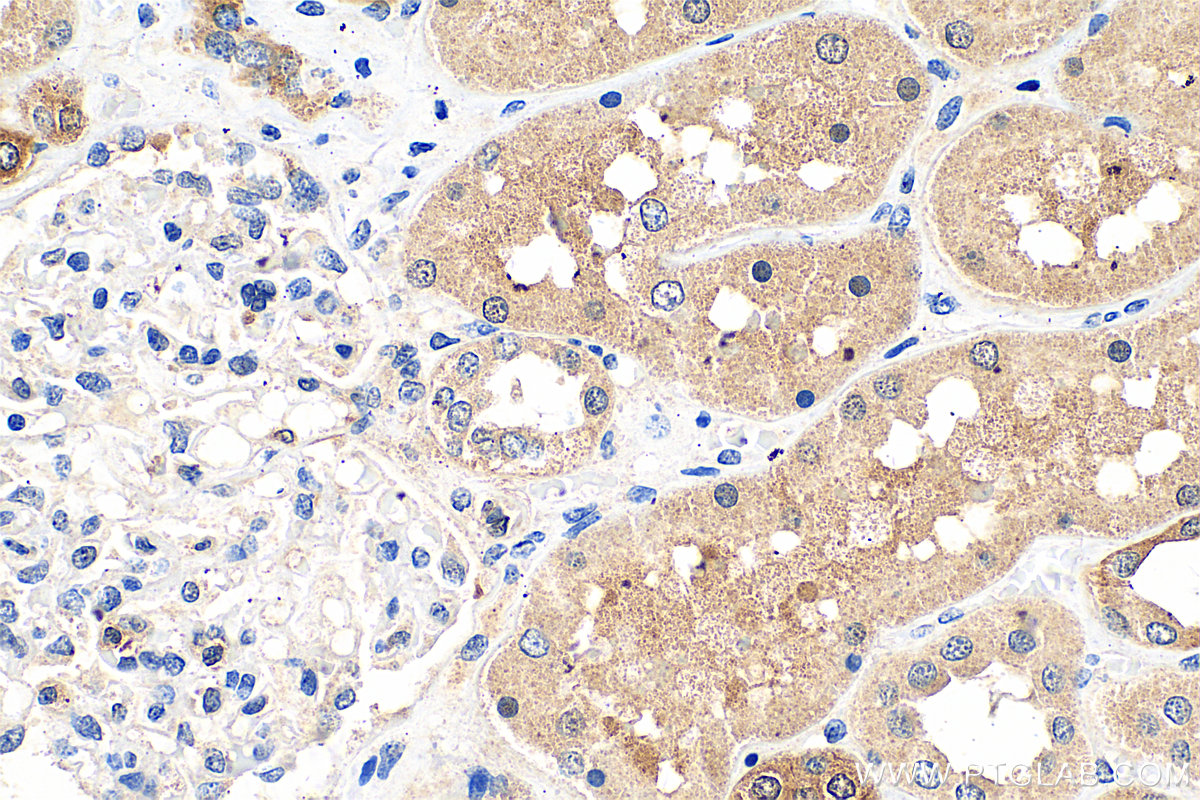 IHC staining of human kidney using 21733-1-AP