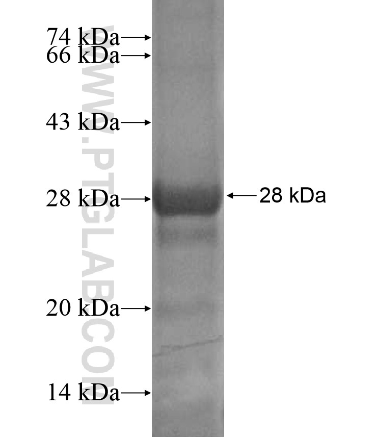 KANK2 fusion protein Ag17284 SDS-PAGE KANK2 fusion protein Ag17284 SDS-PAGE